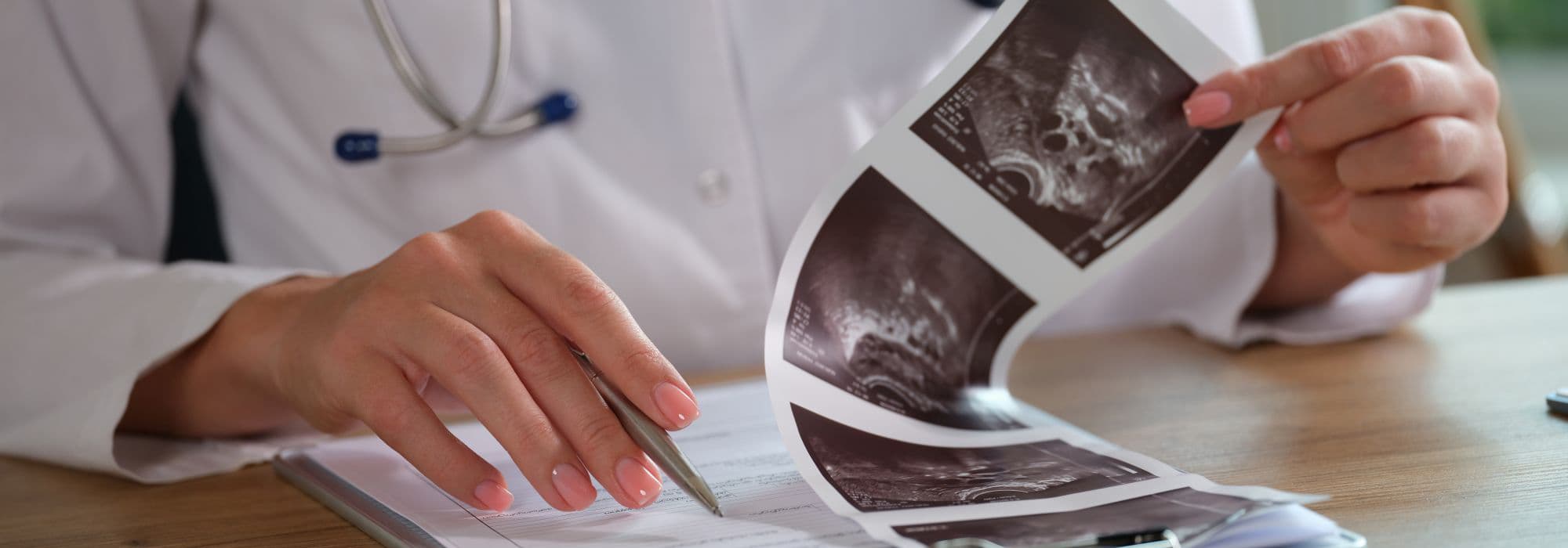 Managing Uterine Fluid for IVF