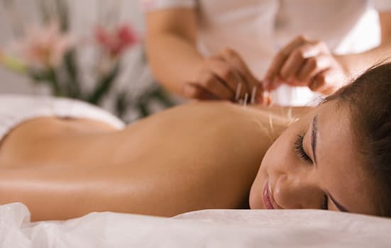 Acupuncture Sessions