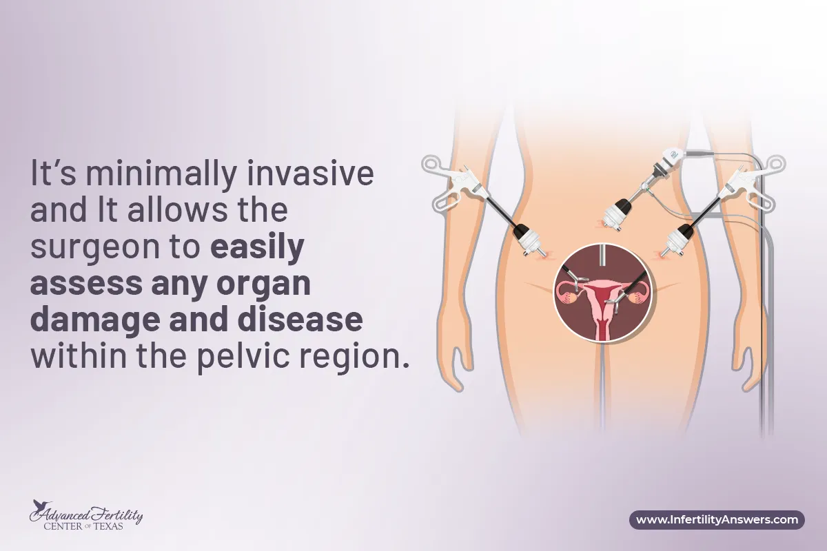 Female Pelvic Laparoscopy