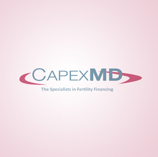 Capex