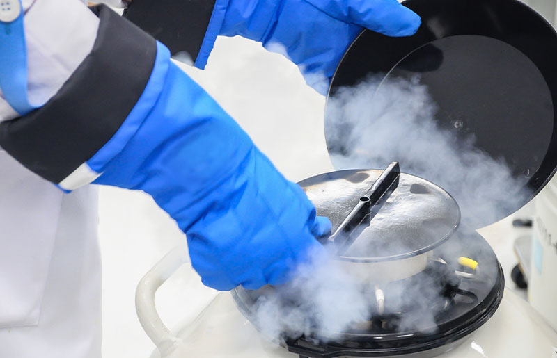 Fertility Preservation Egg or Sperm Freezing