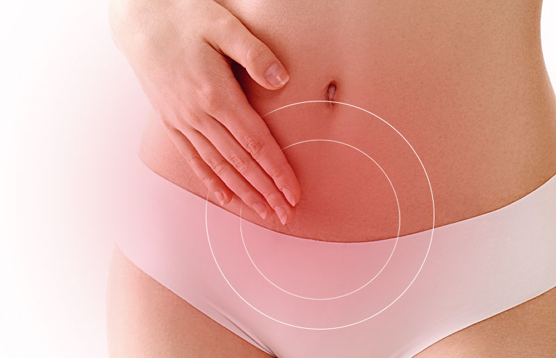 Fibroids