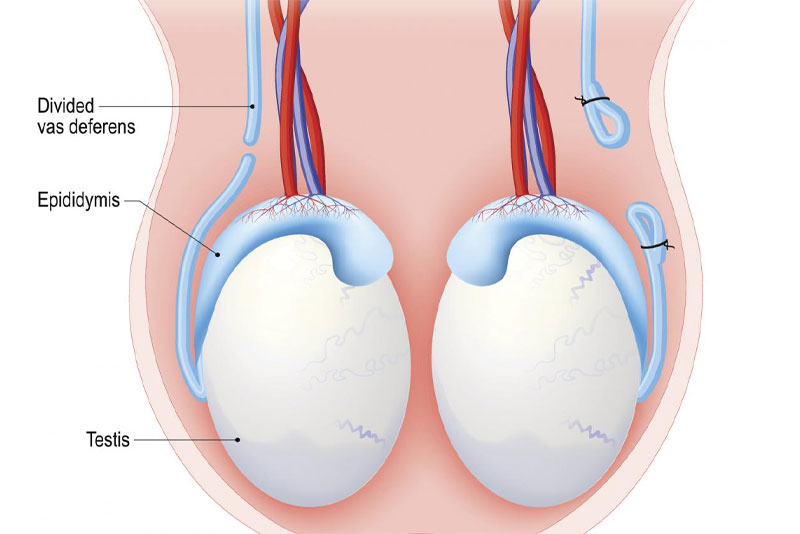 Male Fertility Testing 2
