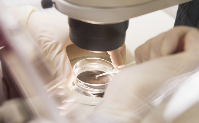 Minimal Stimulation IVF