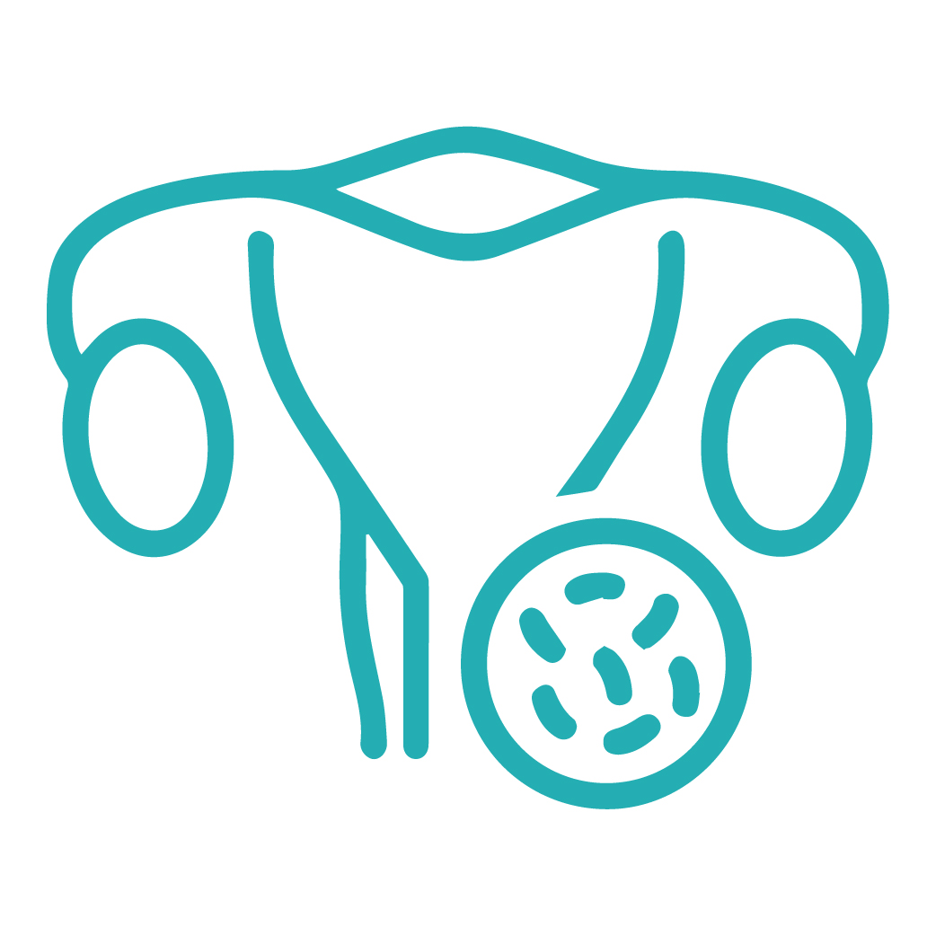 PCOS