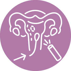 Hysteroscopy Icon Hover