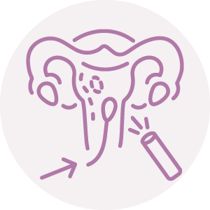 Hysteroscopy Icon