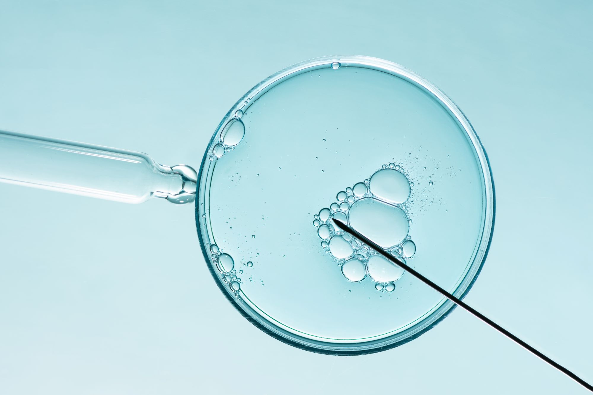 ICSI Precision Fertilization