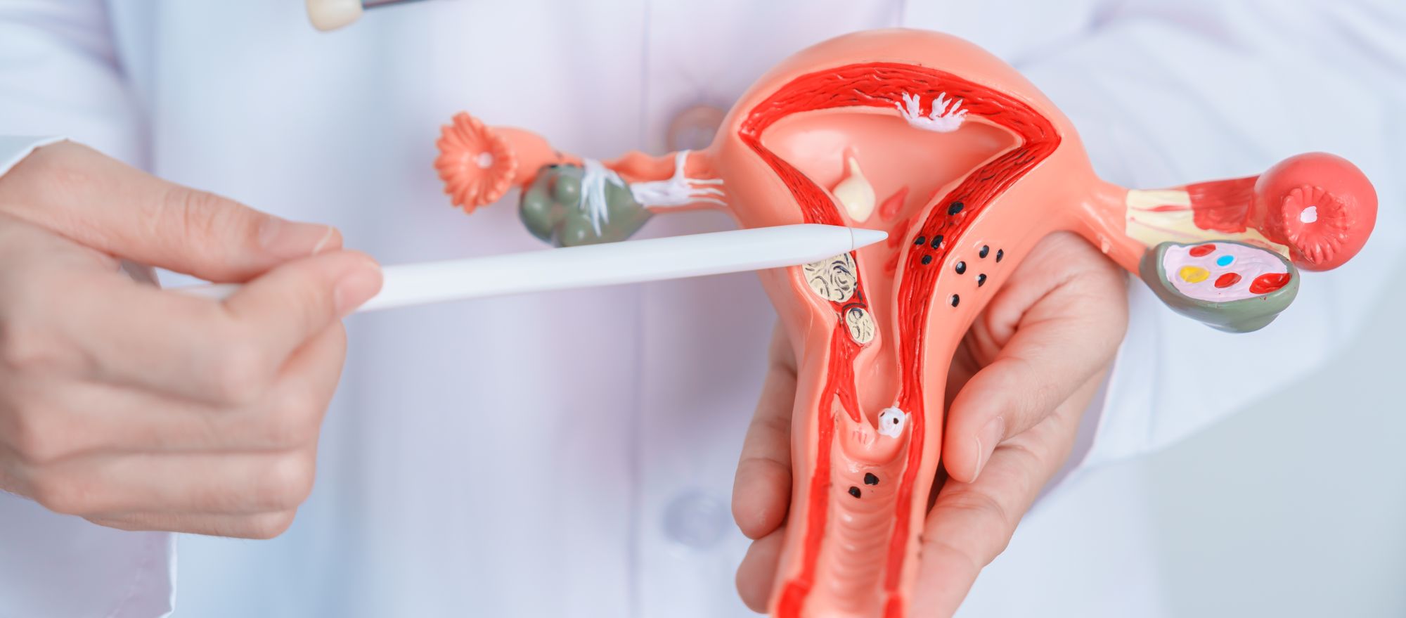 Understanding endometriosis and its impact on fertility