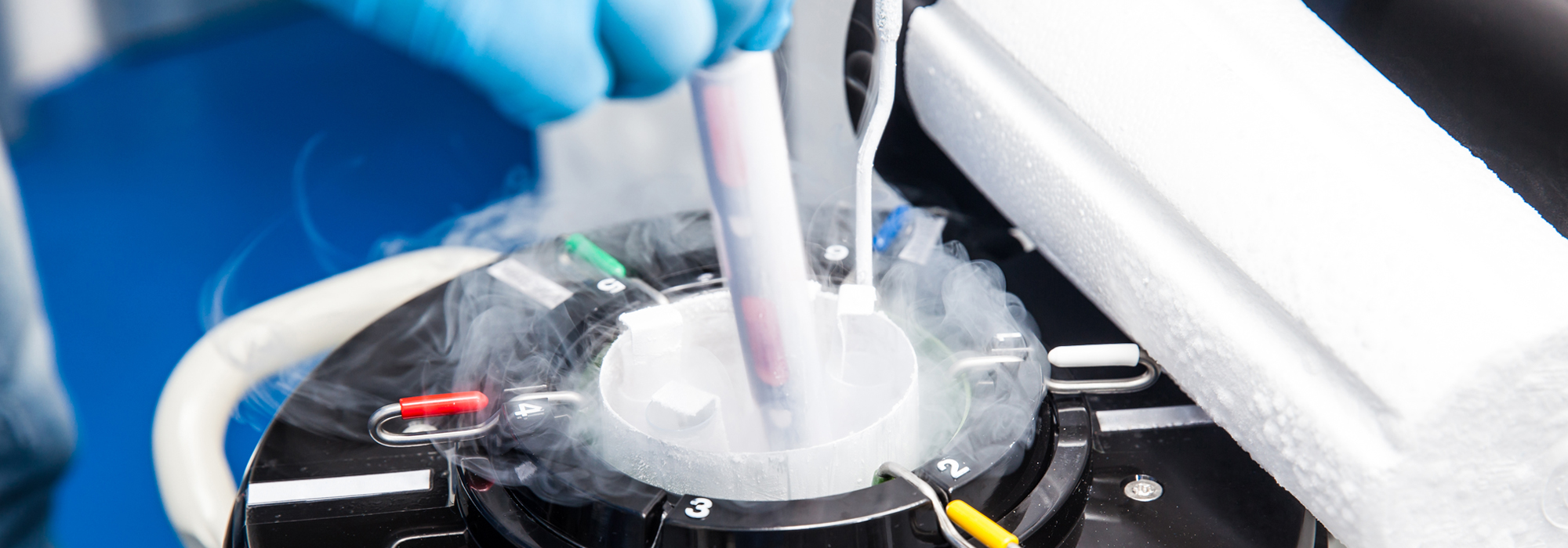 Sperm Cryopreservation & Storage in Houston